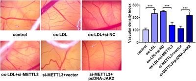 N6-Methyladenosine Methyltransferase METTL3 Promotes Angiogenesis and Atherosclerosis by Upregulating the JAK2/STAT3 Pathway via m6A Reader IGF2BP1